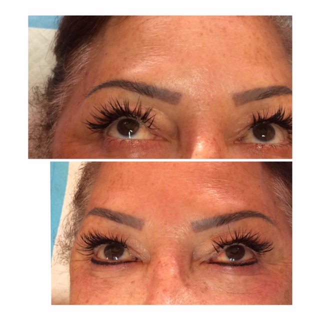 Eyeliner Permanent Makeup Before and After San Antonio