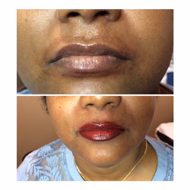 Full Lip Lattoo Before and After Photo