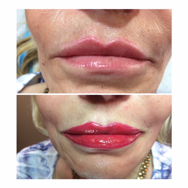Full LIP Permanent Makeup Before and After 